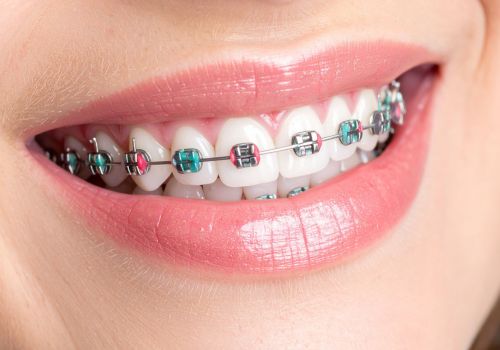 Orthodontics